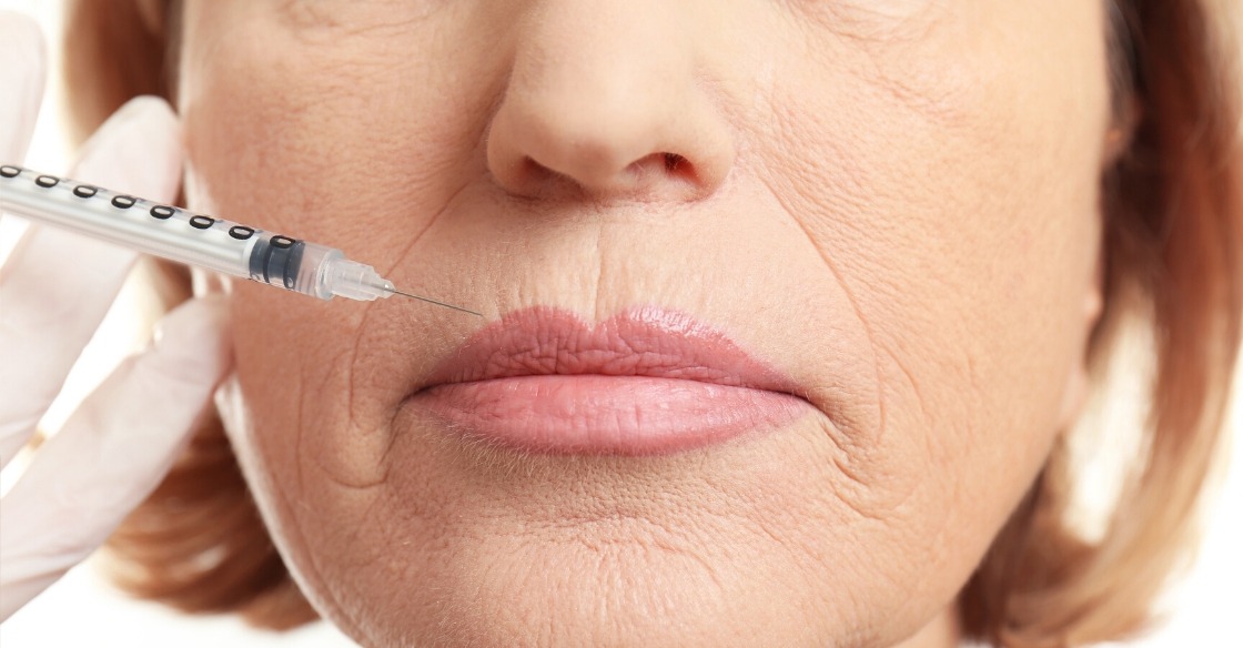 Neurotoxin: A Non-Invasive Alternative to Traditional Wrinkle Treatments