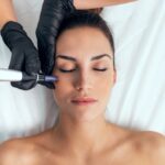 Microneedling for Scarring: How It Works and What To Expect