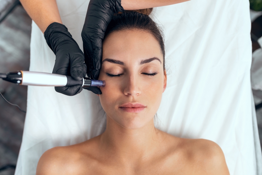 Microneedling for Scarring: How It Works and What To Expect