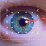 The Advantages of Choosing Lasik Over Glasses or Contacts