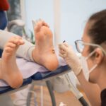 The Different Types of Warts and Their Treatments