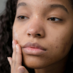 Things to Consider When Choosing the Right Dermatologist