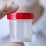 Fertility Services That Address Male Infertility