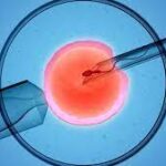 How Infertility Specialists Increase IVF Success