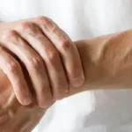 The Connection Between Arthritis and Chronic Inflammation