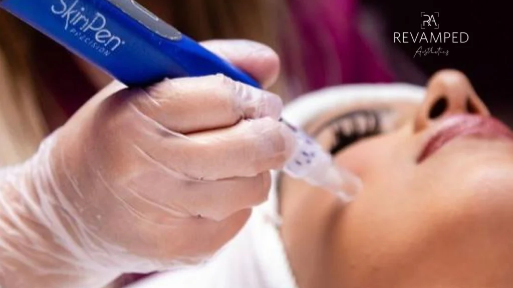 The Connection Between Microneedling and Collagen Production