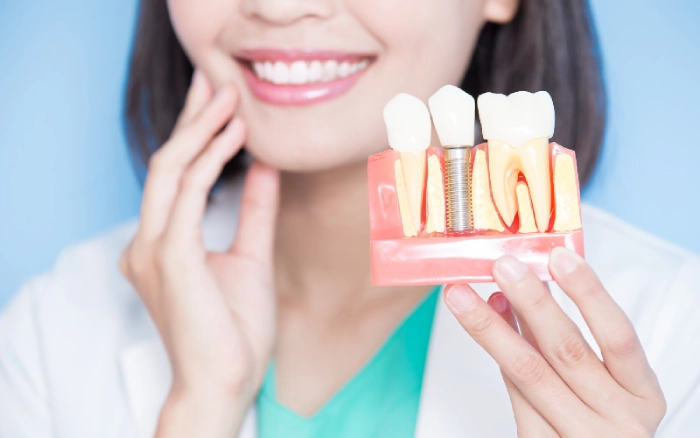 What Issues Require Tooth Replacement?