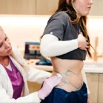 Navigating Your First Few Weeks After Gallbladder Removal Surgery