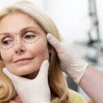 4 Plastic Surgery Questions To Ask Your Surgeon