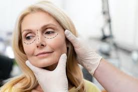 4 Plastic Surgery Questions To Ask Your Surgeon
