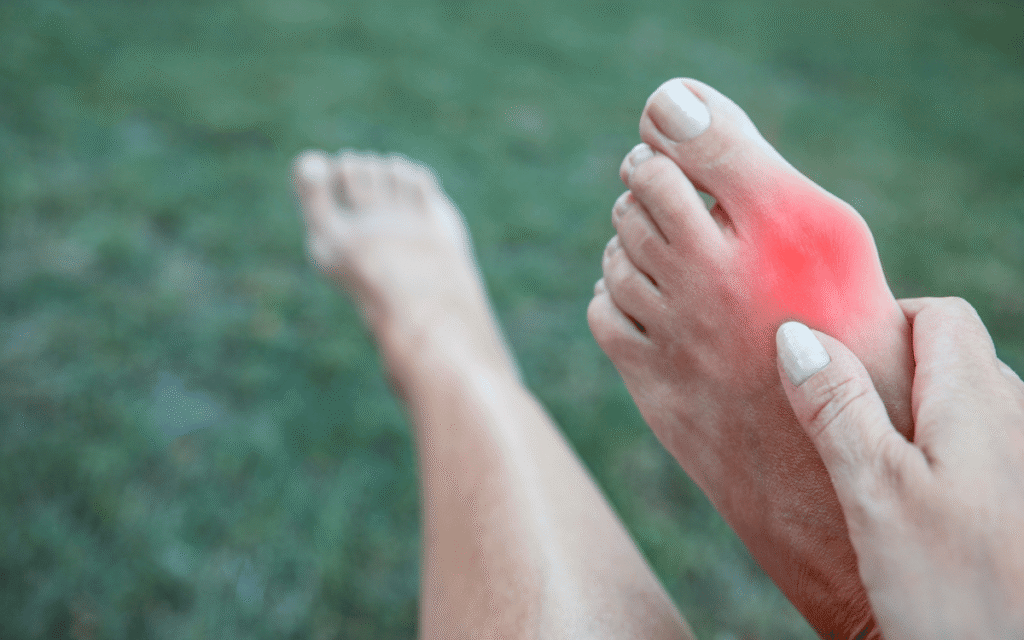 Exploring Surgical and Non-Surgical Treatments for Bunions