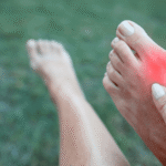 Exploring Surgical and Non-Surgical Treatments for Bunions