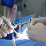 The Role of Robotic Surgery in Minimally Invasive Treatment Options