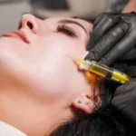 Top Skin Rejuvenation Treatments for Aging Skin