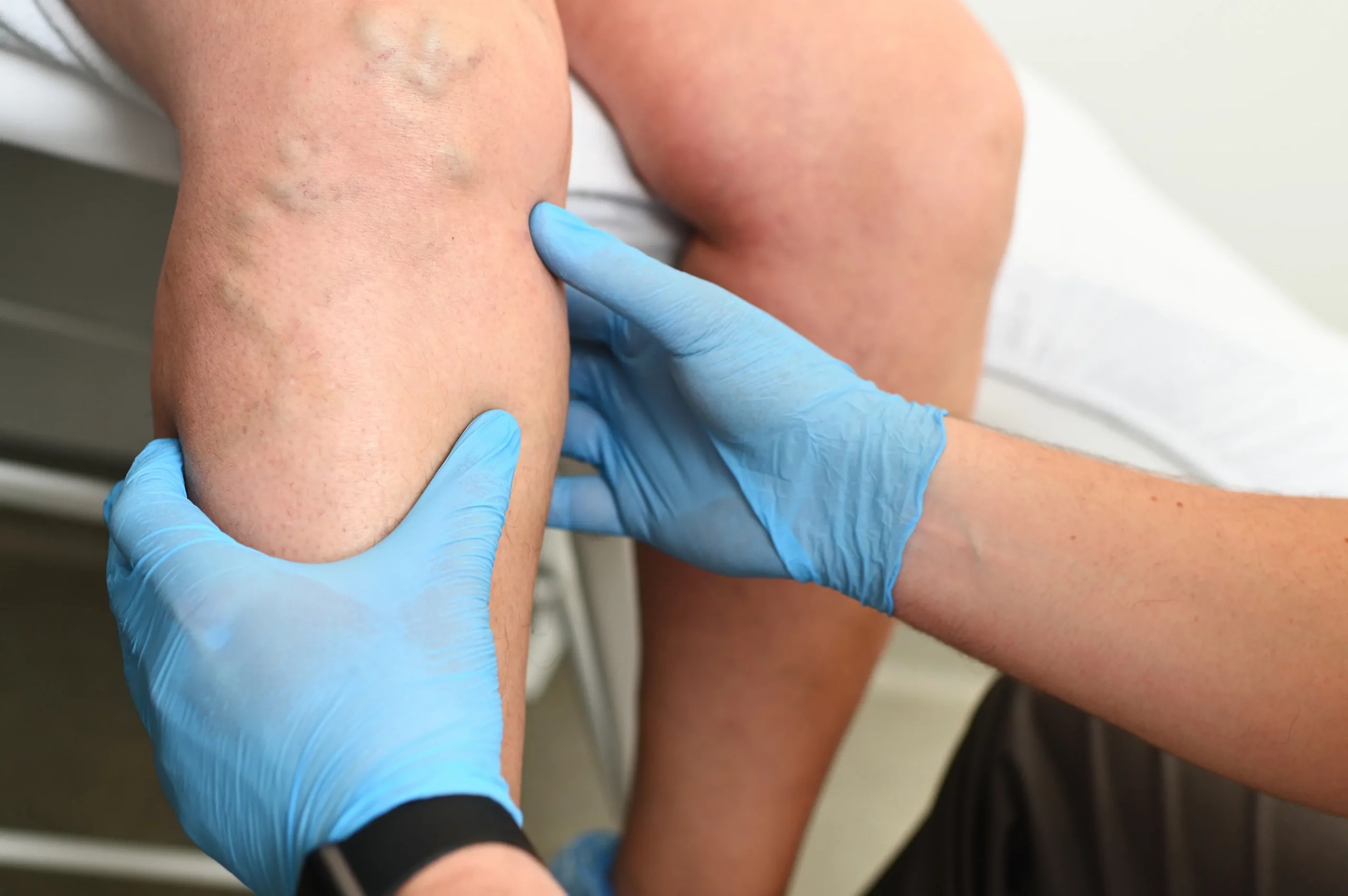 Understanding the Role of Genetics in Vascular Disease