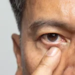 What To Know About Ophthalmologists and Cataract Surgery