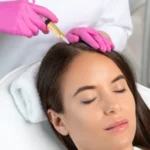Understanding the Recovery Process After PRP Hair Restoration Treatments